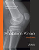 Book cover of: Problem Knee. By: Malcolm F. Macnicol