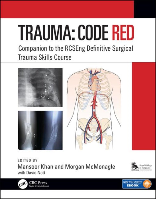 Book cover of: Trauma: Code Red. By: Mansoor Khan