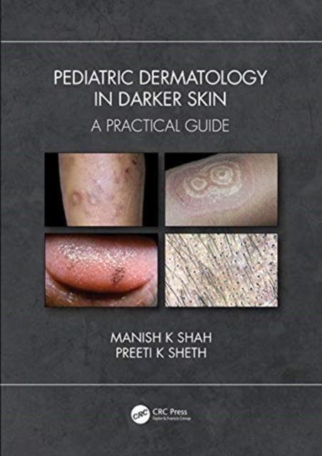 Book cover of: Pediatric Dermatology in Skin of Color. By: Manish K. Shah