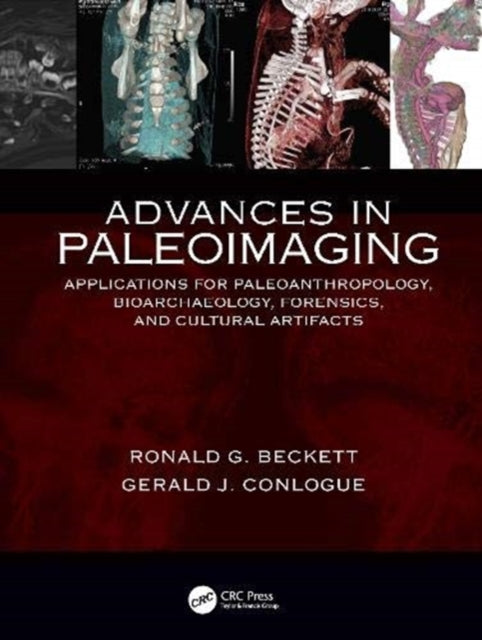 Book cover of: Advances in Paleoimaging. By: Ronald G. Beckett