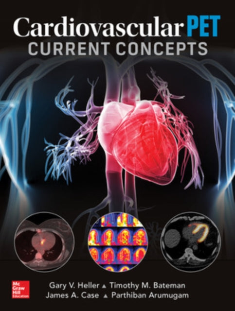 Book cover of: Cardiovascular PET: Current Concepts. By: Gary V. Heller