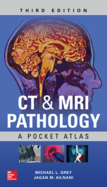 Book cover of: CT & MRI Pathology: A Pocket Atlas, Third Edition. By: Michael Grey