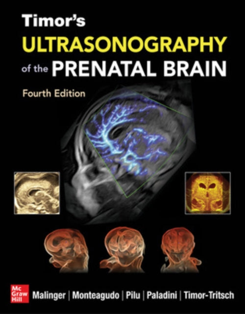 Book cover of: Timor's Ultrasonography of the Prenatal Brain, Fourth Edition. By: Gianluigi Pilu
