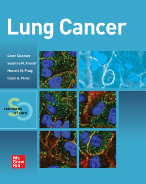 Book cover of: Lung Cancer:  Standards of Care. By: Goetz Kloecker