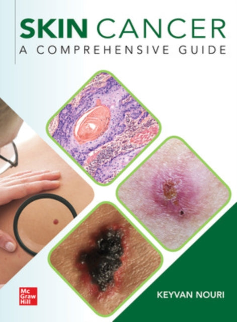 Book cover of: Skin Cancer: A Comprehensive Guide. By: Keyvan Nouri
