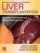 Book cover of: Liver Transplantation: Operative Techniques and Medical Management. By: Ernesto P. Molmenti