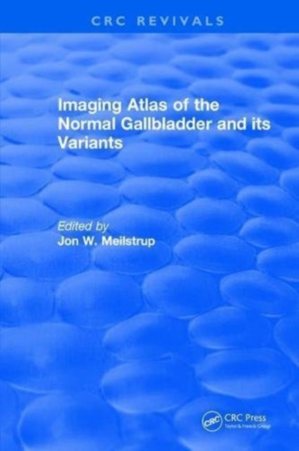 Book cover of: Imaging Atlas of the Normal Gallbladder and Its Variants. By: J. W. Meilstrup