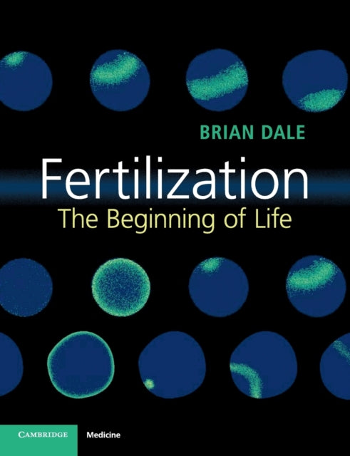 Book cover of: Fertilization. By: Brian Dale