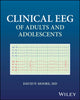 Book cover of: Clinical EEG of Adults and Adolescents. By: David Moore