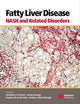 Book cover of: Fatty Liver Disease. By: Jacob George
