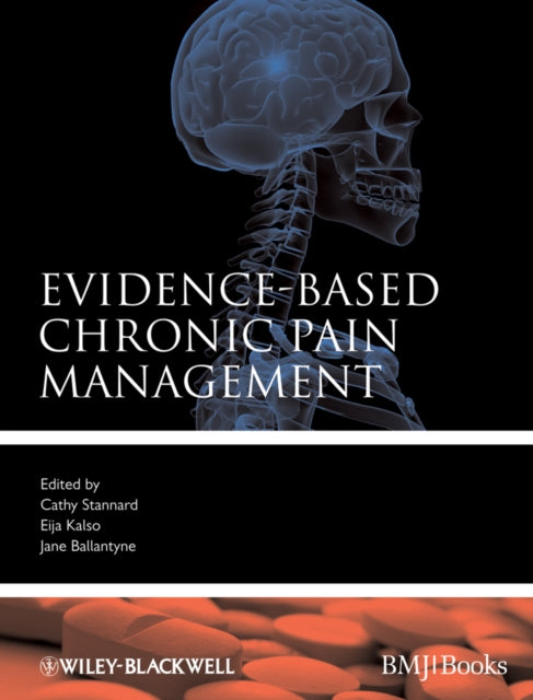 Book cover of: Evidence-Based Chronic Pain Management