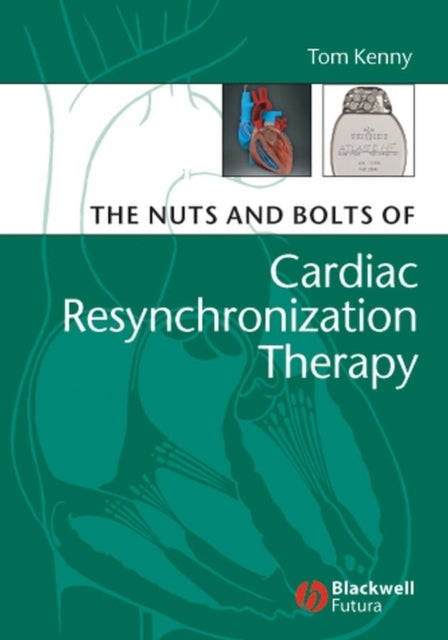 Book cover of: Nuts and Bolts of Cardiac Resynchronization Therapy. By: Tom Kenny, Kenny, Tom