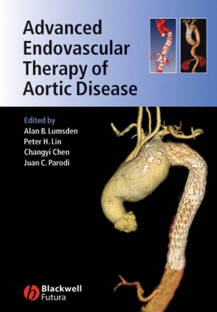 Book cover of: Advanced Endovascular Therapy of Aortic Disease. By: Chen, Changyi.