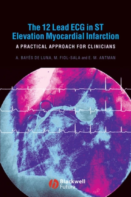 Book cover of: 12 Lead ECG in ST Elevation Myocardial Infarction. By: Antonio Bayés de Luna