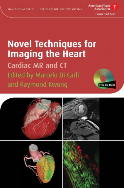 Book cover of: Novel Techniques for Imaging the Heart