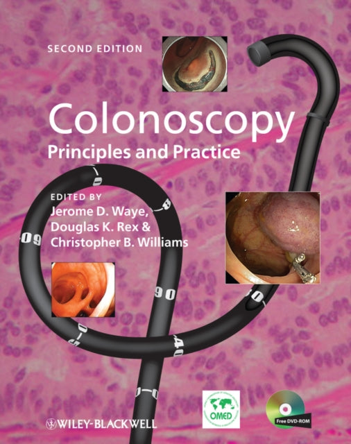 Book cover of: Colonoscopy