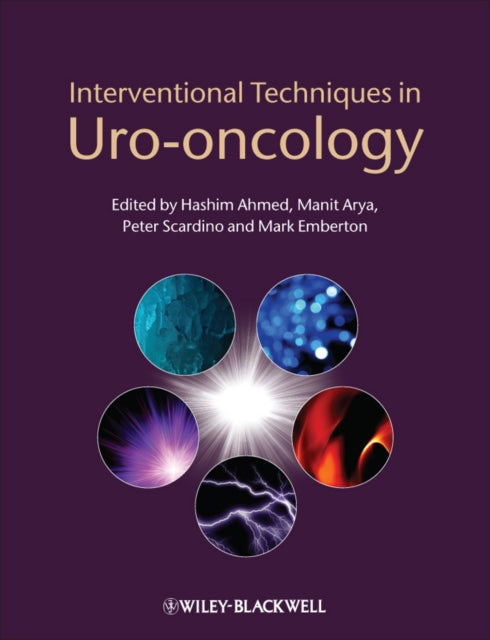 Book cover of: Interventional Techniques in Uro-oncology. By: Hashim Uddin Ahmed