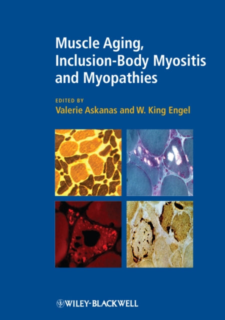 Book cover of: Muscle Aging, Inclusion-Body Myositis and Myopathies. By: Valerie Askanas