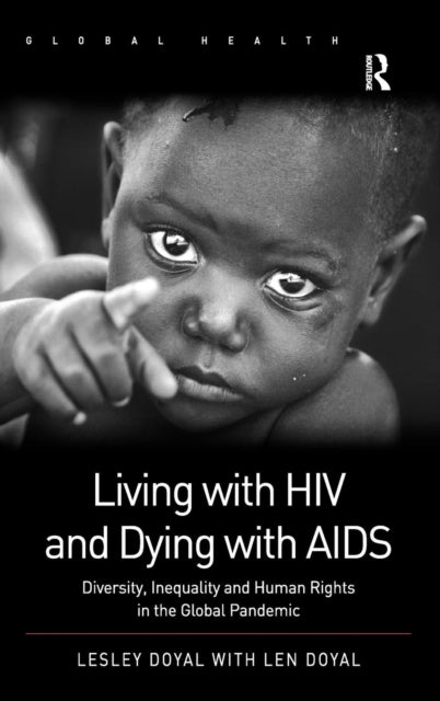 Book cover of: Living with HIV and Dying with AIDS