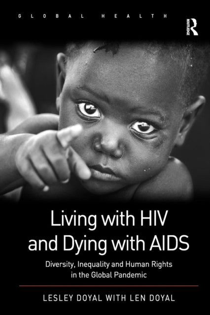 Book cover of: Living with HIV and Dying with AIDS