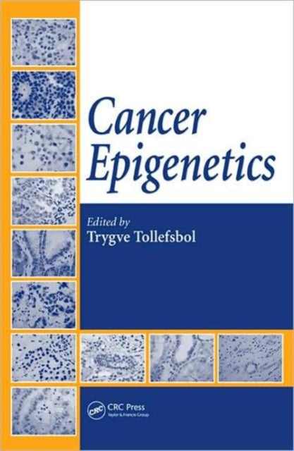 Book cover of: Cancer Epigenetics. By: Trygve O. Tollefsbol