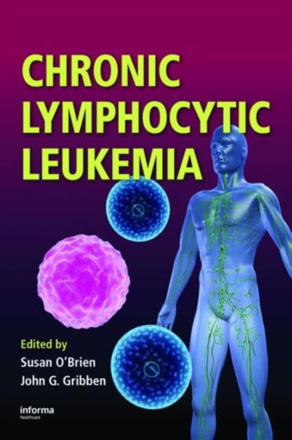 Book cover of: Chronic Lymphocytic Leukemia