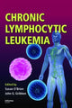Book cover of: Chronic Lymphocytic Leukemia