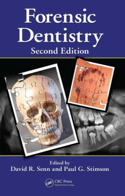 Book cover of: Forensic Dentistry. By: David  R. Senn, David R. Senn