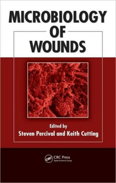 Book cover of: Microbiology of Wounds. By: Steven L. Percival
