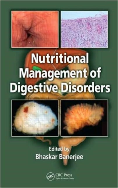 Book cover of: Nutritional Management of Digestive Disorders