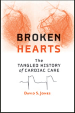 Broken Hearts