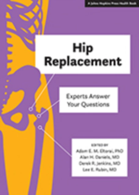 Book cover of: Hip Replacement. By: Adam E. M. Eltorai