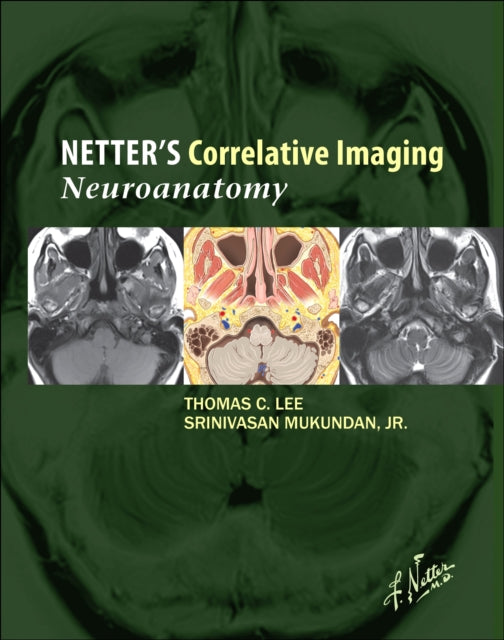Book cover of: Netter's Correlative Imaging: Neuroanatomy. By: Mukundan, Srinivasan, Jr.