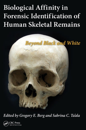Biological Affinity in Forensic Identification of Human Skeletal Remains