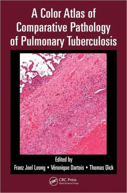 Book cover of: Color Atlas of Comparative Pathology of Pulmonary Tuberculosis. By: F. Joel W.-M Leong