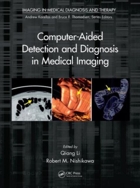 Book cover of: Computer-Aided Detection and Diagnosis in Medical Imaging. By: Qiang Li