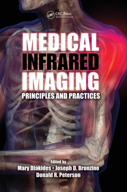 Book cover of: Medical Infrared Imaging. By: Mary Diakides