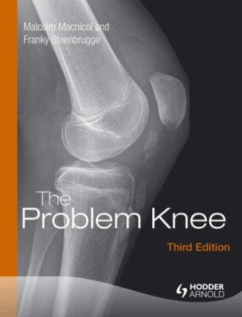 Book cover of: Problem Knee. By: Malcolm F. Macnicol
