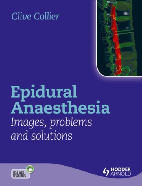 Book cover of: Epidural Anaesthesia: Images, Problems and Solutions. By: Clive Collier