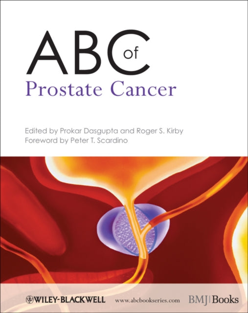 Book cover of: ABC of Prostate Cancer. By: Prokar Dasgupta