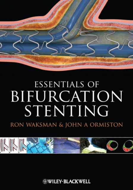 Book cover of: Bifurcation Stenting. By: Ron Waksman