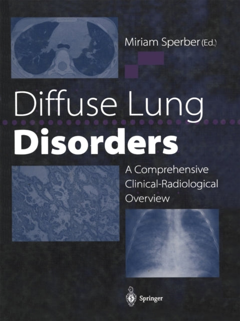 Book cover of: Diffuse Lung Disorders. By: Miriam Sperber