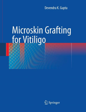 Microskin Grafting for Vitiligo