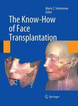 Know-How of Face Transplantation