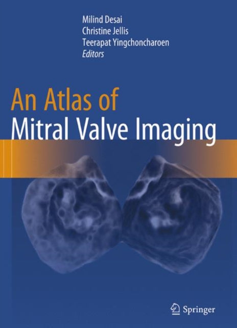 Book cover of: Atlas of Mitral Valve Imaging. By: Milind Desai