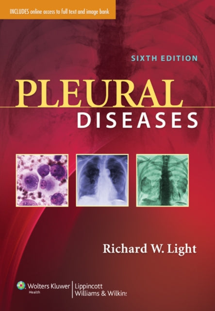 Book cover of: Pleural Diseases. By: Richard W. Light MD