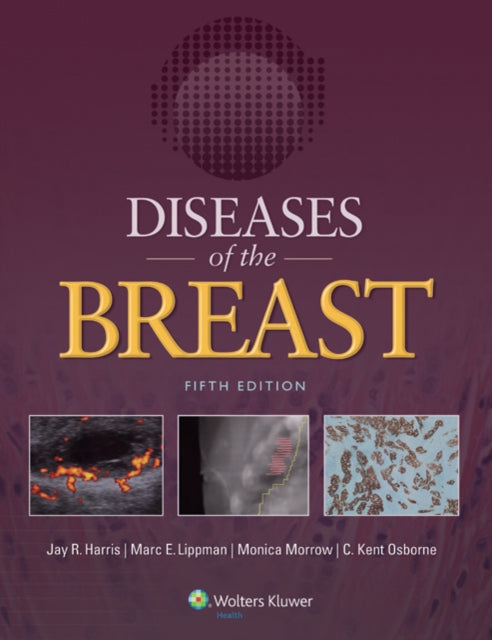 Book cover of: Diseases of the Breast 5e. By: Jay R Harris