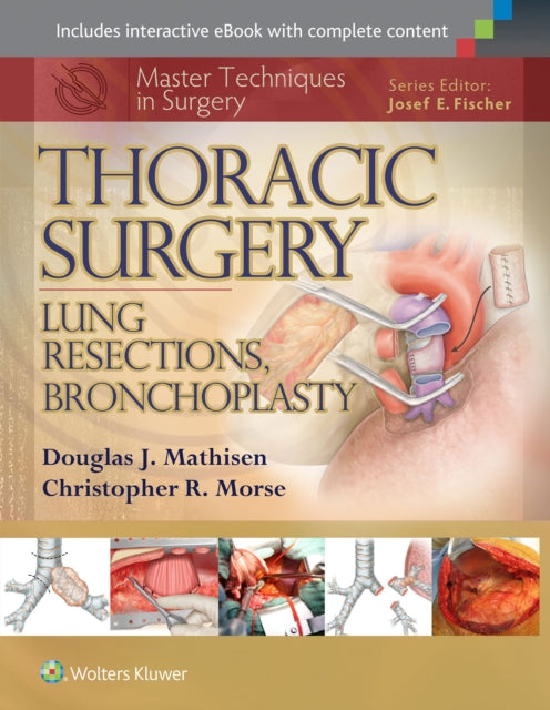 Book cover of: Master Techniques in Surgery: Thoracic Surgery: Lung Resections, Bronchoplasty. By: Douglas J. Mathisen
