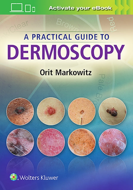 Book cover of: Practical Guide to Dermoscopy. By: Orit Markowitz