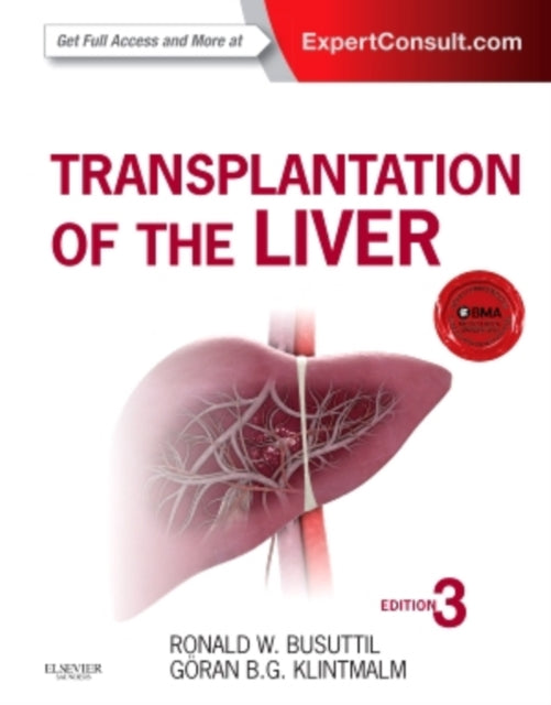 Book cover of: Transplantation of the Liver. By: Ronald W. Busuttil